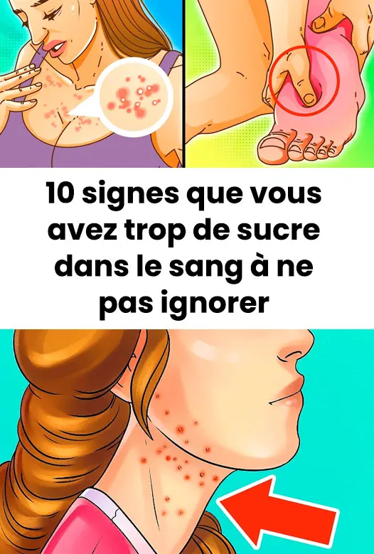 10 signes indiquant que vous consommez trop de sucre.jpg