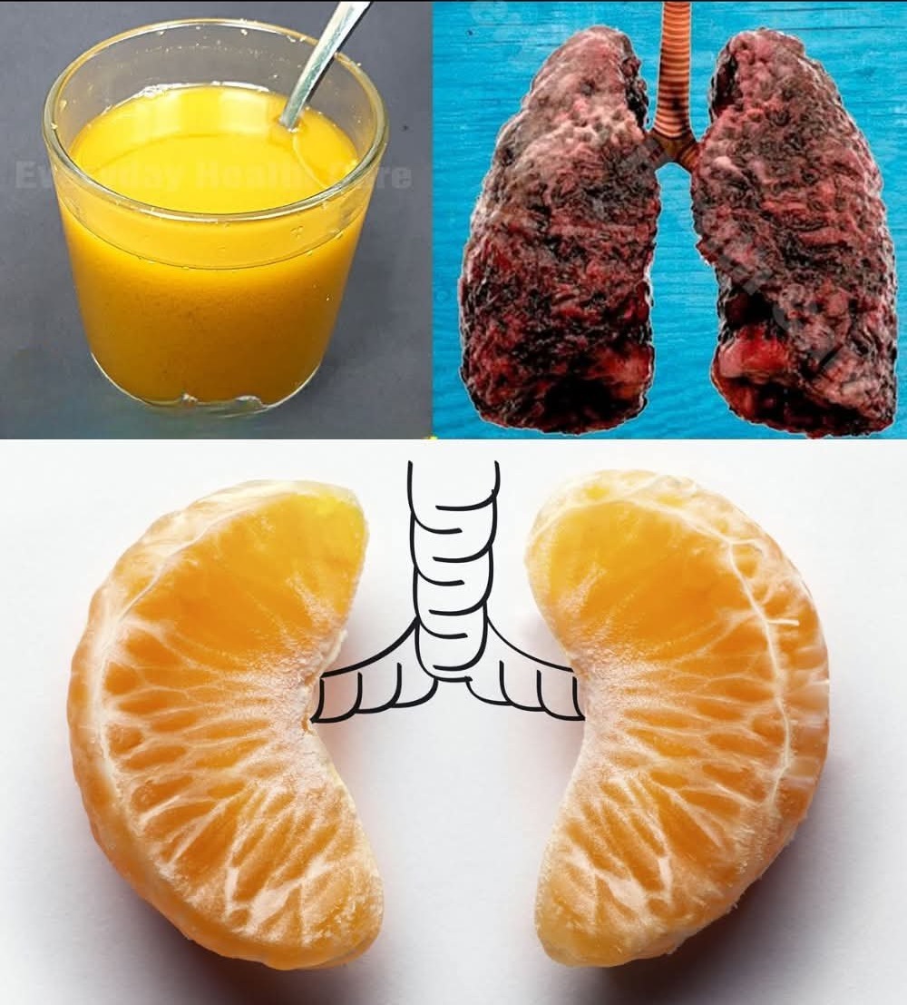 547270912 122180465264521501 4673346374810411447 n