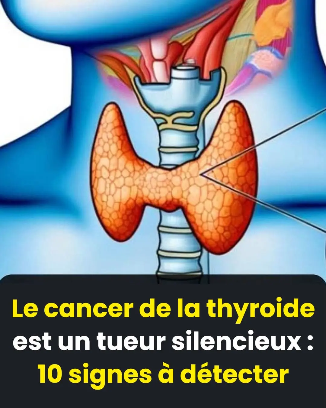 Thyroide 3 symptomes qui peuvent reveler un cancer.jpg
