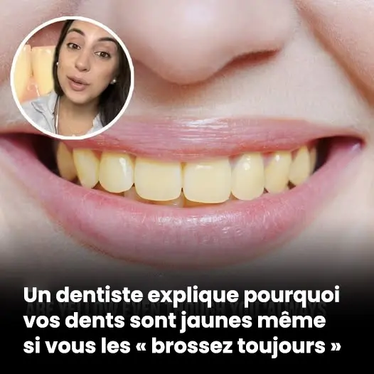Un dentiste explique pourquoi vos dents sont jaunes.jpg