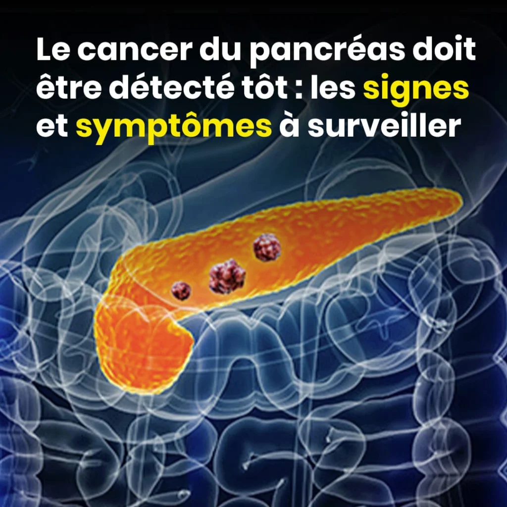 10 signes du cancer du pancreas a ne pas ignorer 1024x1024.jpg