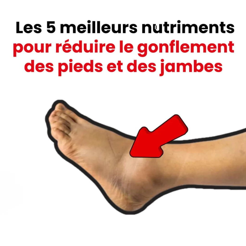 Les 5 meilleurs nutriments pour reduire le gonflement des pieds et des jambes 1024x1024.jpg
