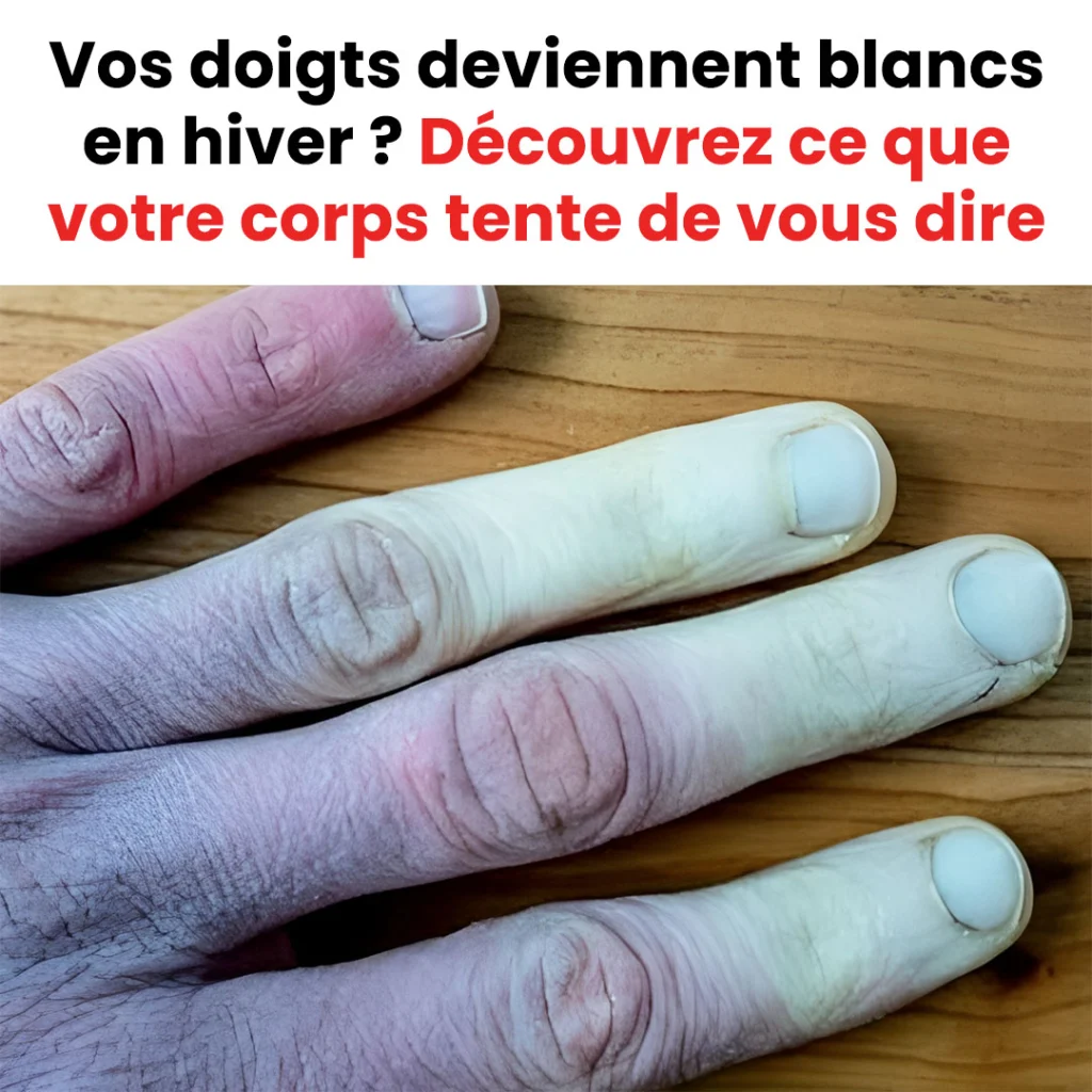 Que faire si vos doigts deviennent blancs en hiver 1024x1024.jpg