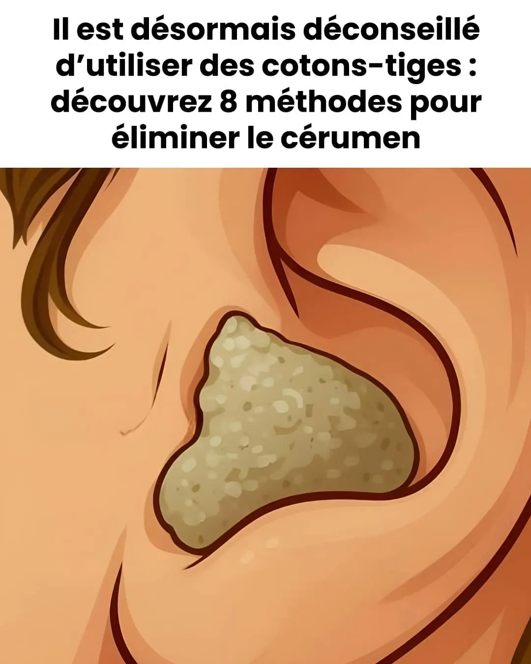 Voici 8 methodes simples et sures pour eliminer laccumulation de cerumen.jpg