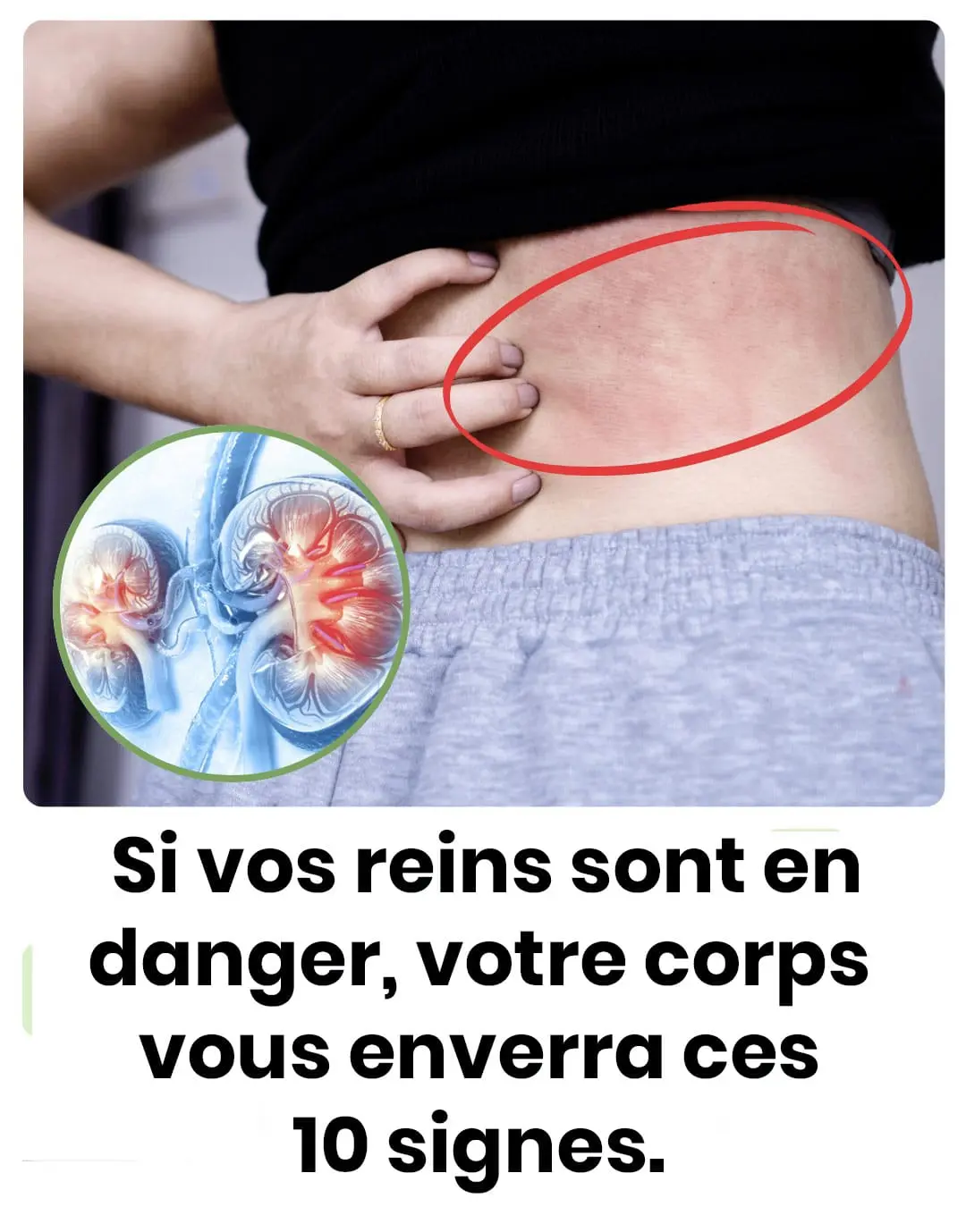 Votre corps vous enverra ces 10 signes si vos reins sont en danger.jpg