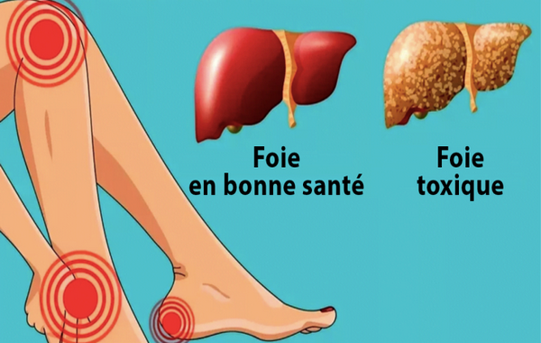 Votre Foie Est Peut Etre Plein De Toxines Voici Comment Le Nettoyer Avec Une Recette Au Citron