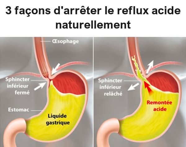 Ebc5edb9 6be5 4ed3 ab51 ed12a116baad