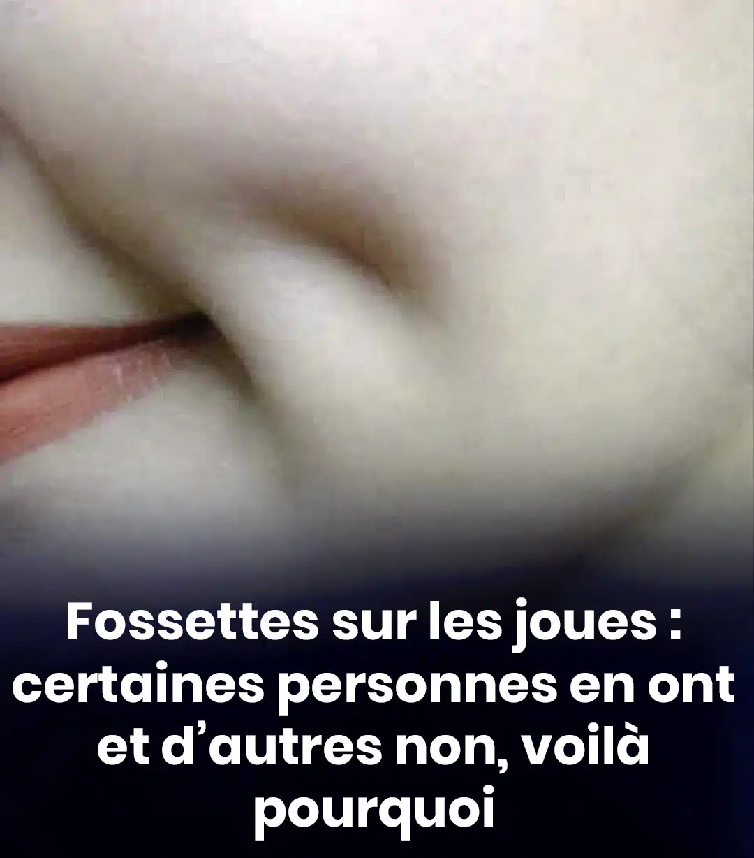 Fossettes sur la joue pourquoi certaines personnes en ont et dautres non.jpg (2)