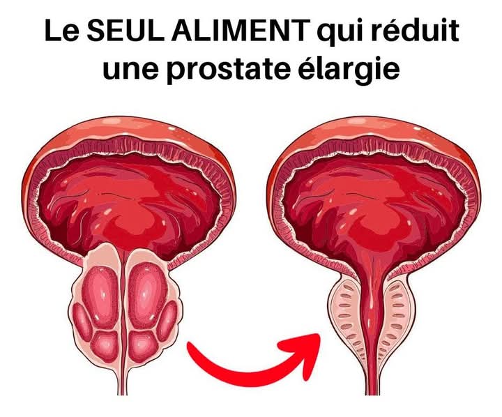 B1d9fb83 b891 4a9b bab6 8a02df72afc1