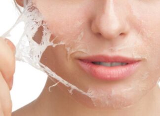 Piel mariposa 500x334 1 324x235